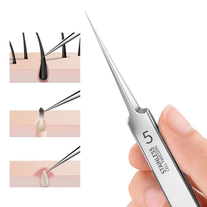 Stainless Steel Blackhead Removal Tweezers - Professional Comedone Extractor and Whitehead Removal Tool for Deep Cleansing