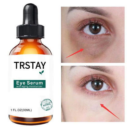 Retinol Anti-Aging and Whitening Eye Serum with Oil Control - Gold Infused Korean Skincare